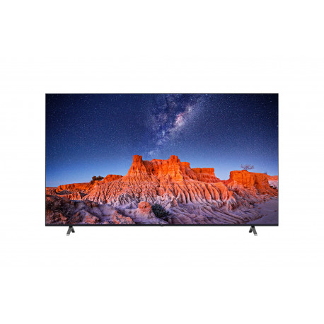 SMART TV LG 75" - 4K UHD - Hauts parleurs 20W - 75UQ801C