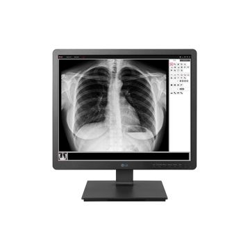 ECRAN LG 19 NOIR IPS 1.3MP 330cd/m² 14ms 1280x1024 SRGB 72% HDMI Displayport D-sub USB 3.0 dispositif médical Mode Flicker Safe & Read Pivot